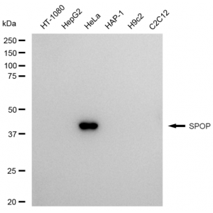 LifeSab™ SPOP Rabbit mAb (20 μl)