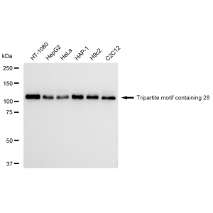 LifeSab™ TRIM28 Rabbit mAb (20 μl)