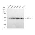 LifeSab™ IL11RA Rabbit mAb (20 μl)