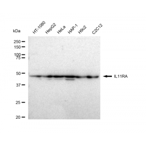 LifeSab™ IL11RA Rabbit mAb (20 μl)