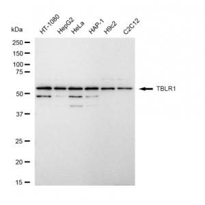 LifeSab™ TBLR1 Rabbit mAb (20 μl)