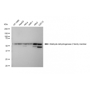 LifeSab™ ALDH2 Rabbit mAb (20 μl)