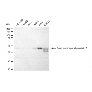 LifeSab™ BMP7 Rabbit mAb (20 μl)
