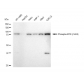 LifeSab™ Phospho-BTK (Y223) Rabbit mAb (20 μl)