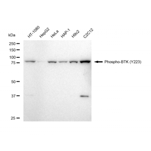 LifeSab™ Phospho-BTK (Y223) Rabbit mAb (20 μl)