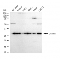 LifeSab™ GSTM1 Rabbit mAb (20 μl)