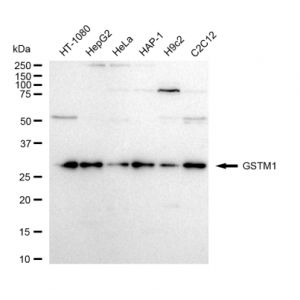 LifeSab™ GSTM1 Rabbit mAb (20 μl)