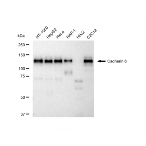 LifeSab™ CDH6 Rabbit mAb (20 μl)