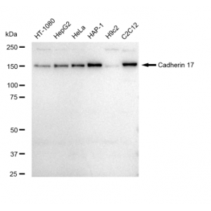 LifeSab™ CDH17 Rabbit mAb (20 μl)