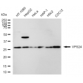LifeSab™ VPS24 Rabbit mAb (20 μl)