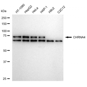 LifeSab™ CHRNA4 Rabbit mAb (20 μl)