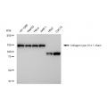 LifeSab™ COL11A1 Rabbit mAb (20 μl)