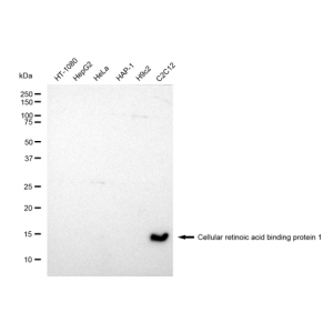 LifeSab™ COL11A1 Rabbit mAb (20 μl)