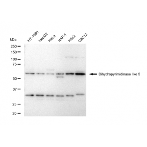 LifeSab™ DPYSL5 Rabbit mAb (20 μl)