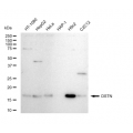 LifeSab™ DSTN Rabbit mAb (20 μl)