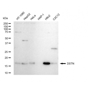 LifeSab™ DSTN Rabbit mAb (20 μl)