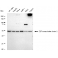 LifeSab™ E2F2 Rabbit mAb (20 μl)