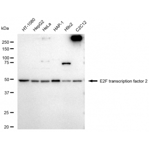 LifeSab™ E2F2 Rabbit mAb (20 μl)