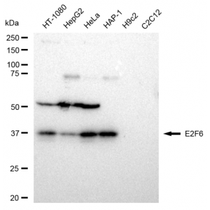 LifeSab™ E2F6 Rabbit mAb (20 μl)