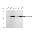 LifeSab™ EPHB3 Rabbit mAb (20 μl)