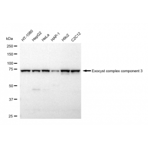 LifeSab™ EXOC3 Rabbit mAb (20 μl)