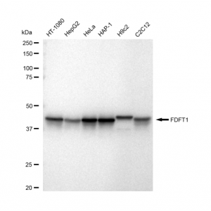 LifeSab™ FDFT1 Rabbit mAb (20 μl)