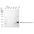 LifeSab™ FGF21 Rabbit mAb (20 μl)