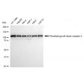 LifeSab™ FGFR4 Rabbit mAb (20 μl)