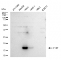 LifeSab™ FHIT Rabbit mAb (20 μl)