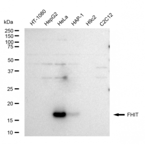 LifeSab™ FHIT Rabbit mAb (20 μl)