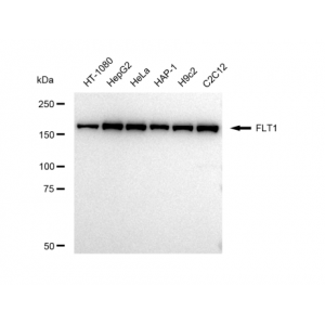 LifeSab™ FLT1 Rabbit mAb (20 μl)
