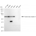 LifeSab™ FZD8 Rabbit mAb (20 μl)
