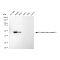 LifeSab™ FZD9 Rabbit mAb (20 μl)