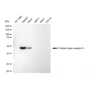LifeSab™ FZD9 Rabbit mAb (20 μl)