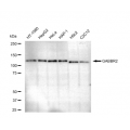LifeSab™ GABBR2 Rabbit mAb (20 μl)