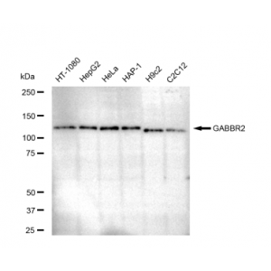 LifeSab™ GABBR2 Rabbit mAb (20 μl)