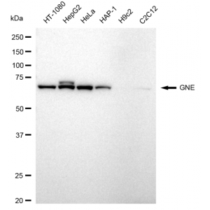 LifeSab™ GNE Rabbit mAb (20 μl)