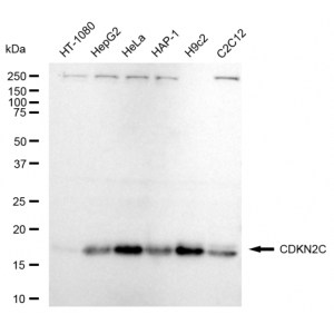 LifeSab™ CDKN2C Rabbit mAb (20 μl)