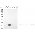 LifeSab™ CDKN2A Rabbit mAb (20 μl)