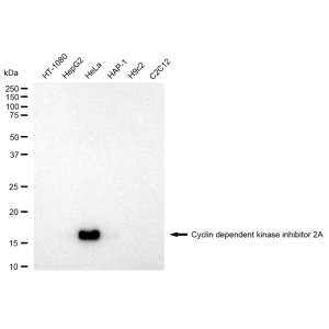 LifeSab™ CDKN2A Rabbit mAb (20 μl)