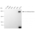 LifeSab™ VWF Rabbit mAb (20 μl)