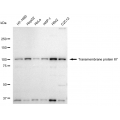 LifeSab™ TMEM67 Rabbit mAb (20 μl)