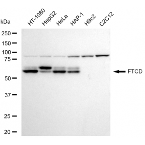 LifeSab™ FTCD Rabbit mAb (20 μl)