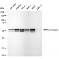 LifeSab™ Aromatase Rabbit mAb (20 μl)
