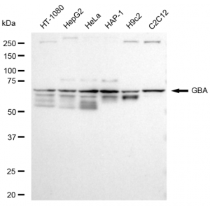 LifeSab™ GBA Rabbit mAb (20 μl)