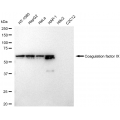 LifeSab™ FIX Rabbit mAb (20 μl)