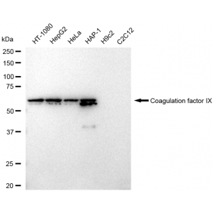 LifeSab™ FIX Rabbit mAb (20 μl)