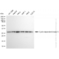 KD-Validated CDK5 Rabbit mAb (20 μl)