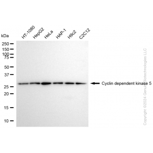 KD-Validated CDK5 Rabbit mAb (20 μl)