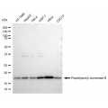 LifeSab™ KD-Validated PPIB Rabbit mAb (20 μl)